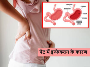 Abdomen Infection 